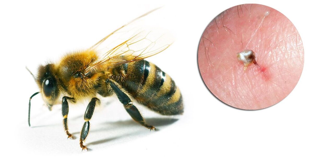 ჰონდროსტრონგი შეიცავს ფუტკრის შხამს, რომელიც აუმჯობესებს ქსოვილებში მეტაბოლურ პროცესებს